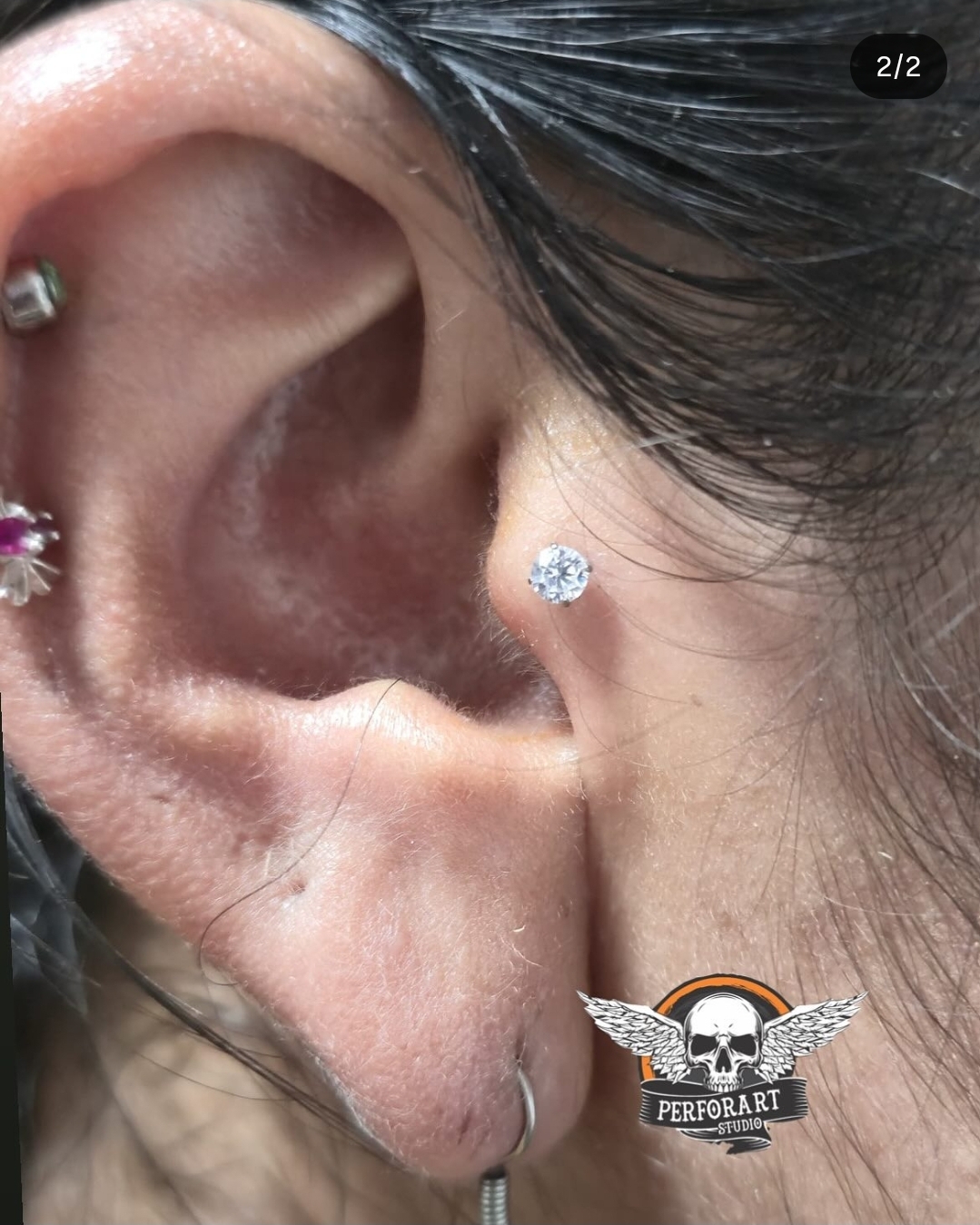 Tragus